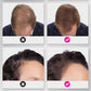 🔥BUY 2 GET 1 FREE💝Hair Thickening Hair Building Fiber Powder